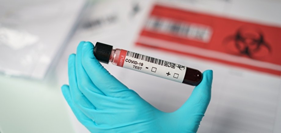 Coronavirus-Tests,eine Hand hält Tube von Blut-Testproben von